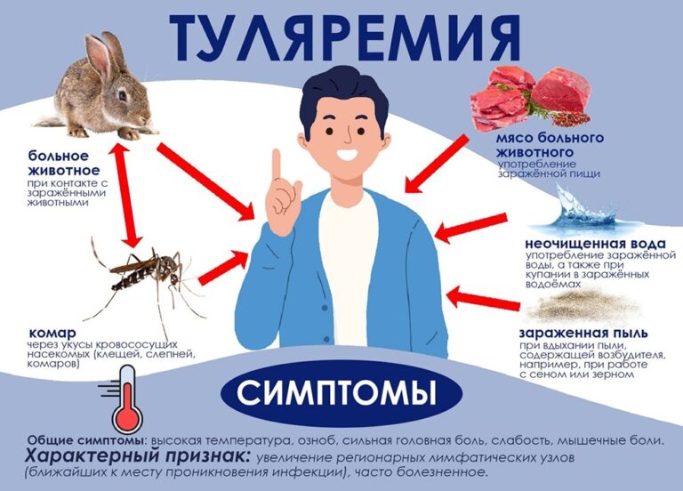 Туляремия